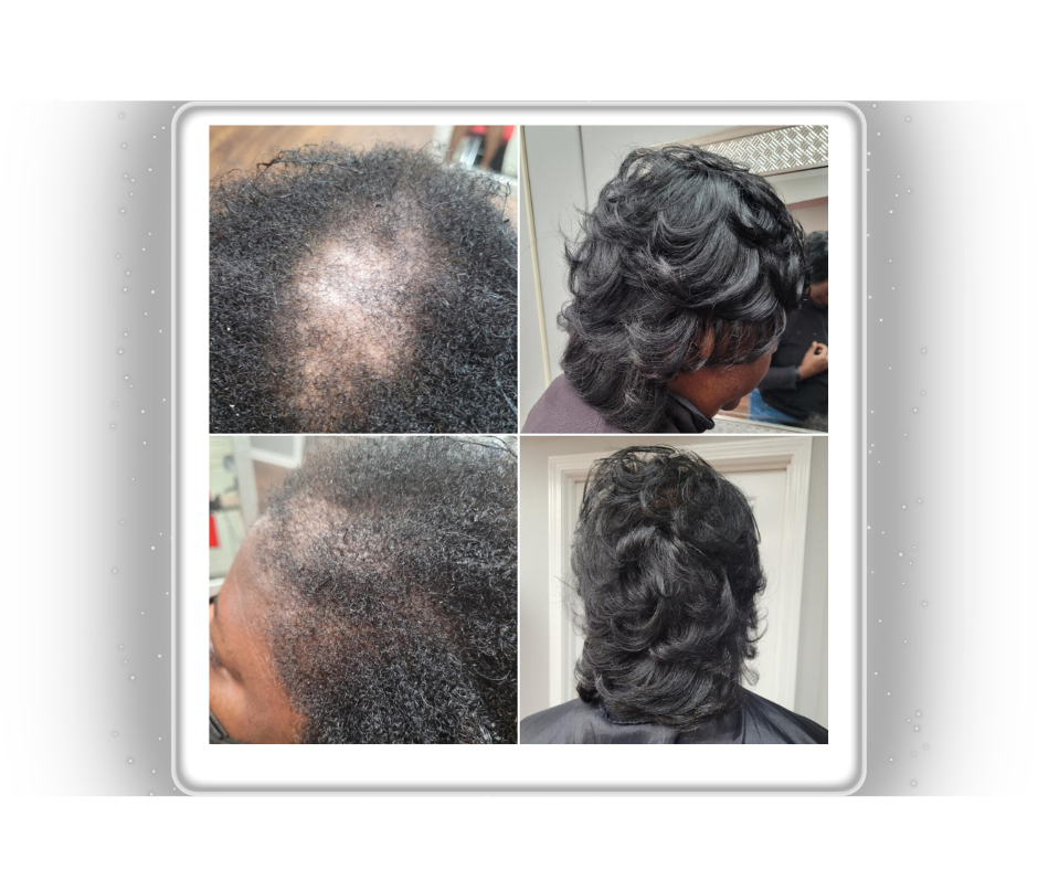 D’Serv Chebe Food Treatment